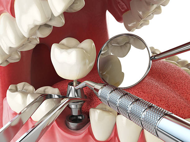 Best Same-Day Emergency Dental Services in Peachtree City, GA